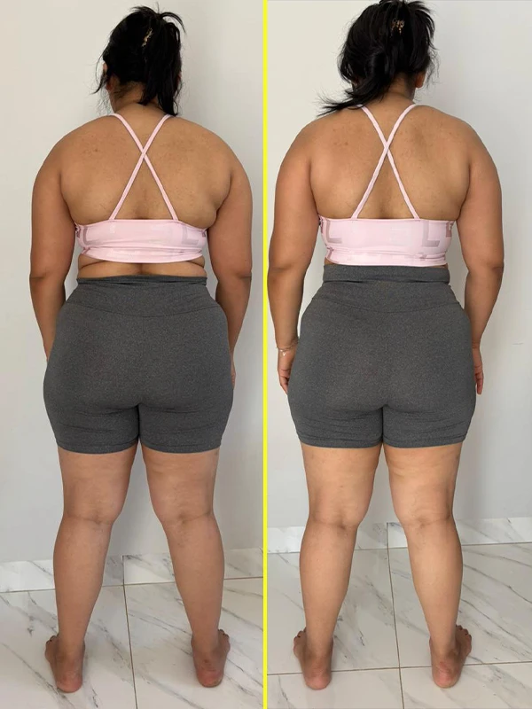 4 antes e depois copiar