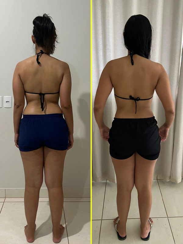 7 antes e depois copiar